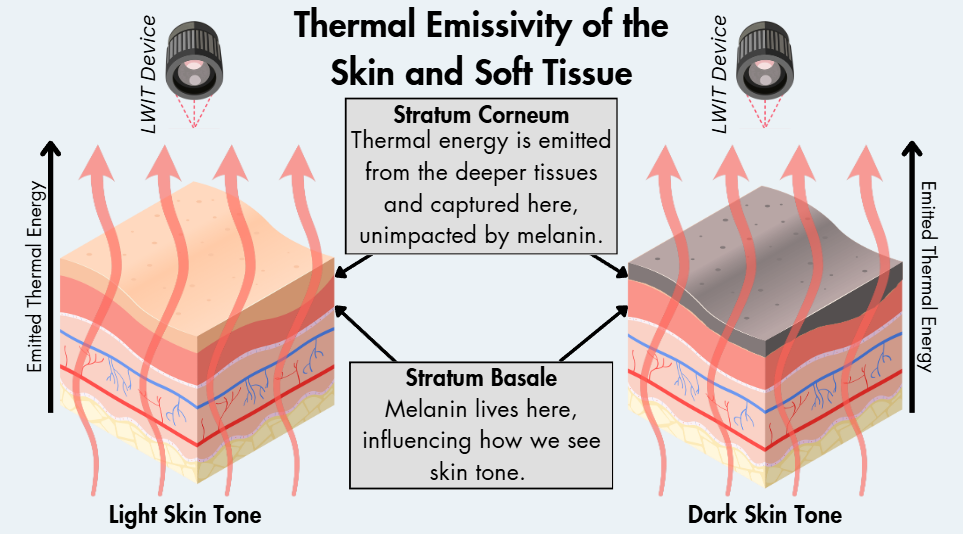 Thermal_Emissivity