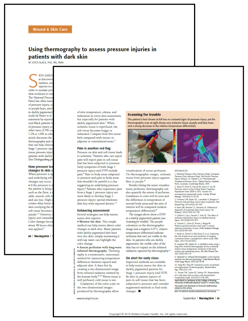 Using Thermography to Assess Pressure Injuries in Patients With Dark Skin